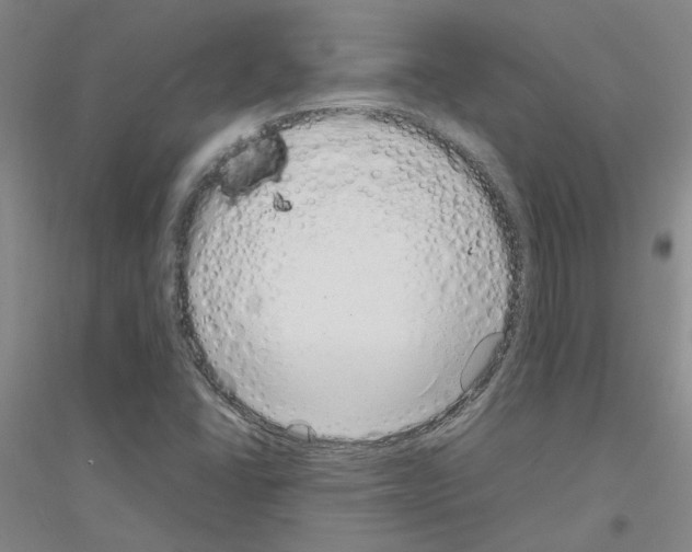 X0000116881406201002021138